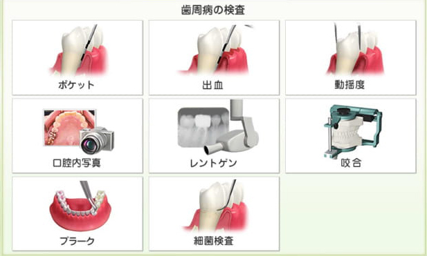 歯周検査