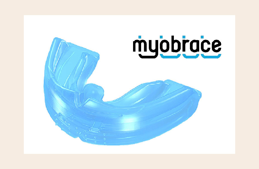 マイオブレイスアクティビティとは？