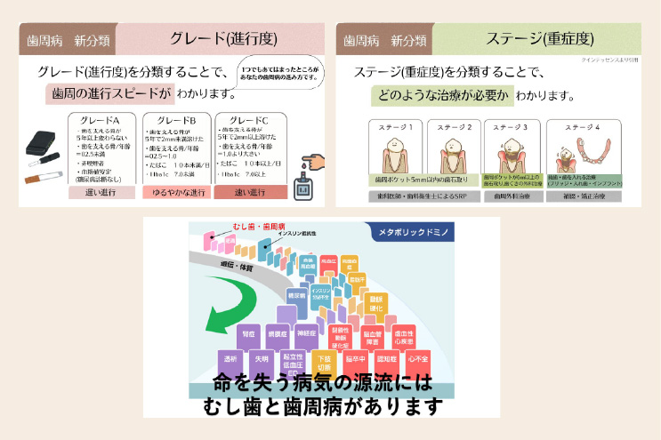 ステージ・グレード分類とは？