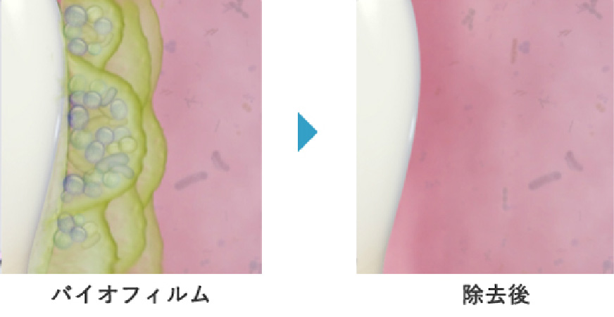 定期的な専門メンテナンスが最重要